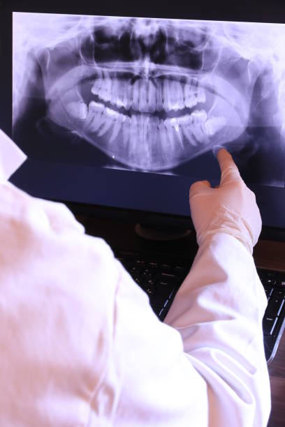 Best Emergency Wisdom Teeth Removal in Bridgeville, DE